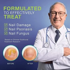 Extra Strength Toenail Fungus Treatment For Toenail Or Fingernail, Nail Repair Solution, Nail Renewal Liquid For Damaged & Discoloration Nail(1oz)