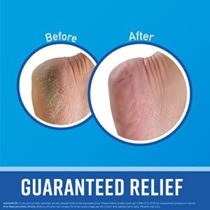 O’Keeffe’s for Healthy Feet Foot Cream, Guaranteed Relief for Extremely Dry, Cracked Feet, Instantly Boosts Moisture Levels, 3.2 Ounce Jar, (Pack of 1)