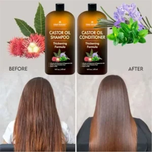 Castor Oil Shampoo and Conditioner – An Anti Hair Loss Set Thickening formula For Hair Regrowth, Anti Thinning Sulfate Free For Men & Women Anti Dandruff Treatment – 16 oz