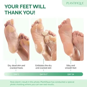 PLANTIFIQUE Foot Peeling Mask – Dermatologically Tested to Repair Heels & Remove Dead Skin for Baby Soft Feet – Exfoliating Peel Mask for Cracked Feet (Peach, 2 pack)